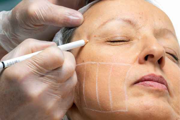 CryoPen: 5 Skin Concerns It May Be Used to Treat 4 What should you ask before having CryoPen treatment Wednesbury?