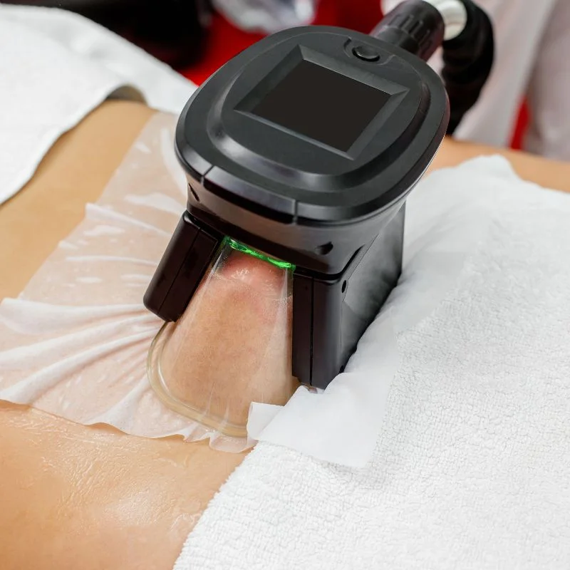 Fat Freezing treatment Wednesbury
